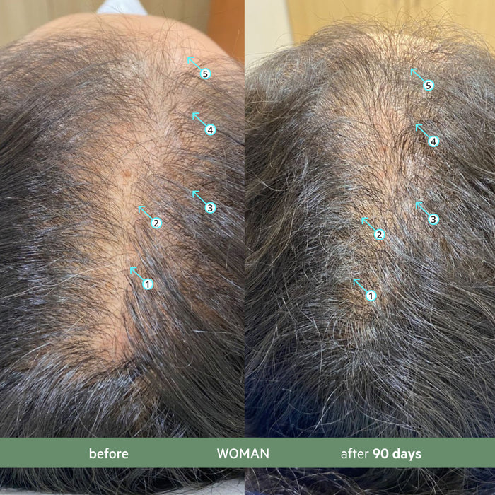 Revita.CBD | Super Antioxidant Hair DENSITY CBD Conditioner