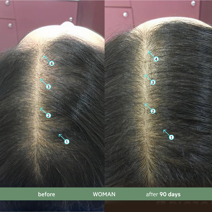 Revita.CBD | Super Antioxidant Hair DENSITY CBD Shampoo